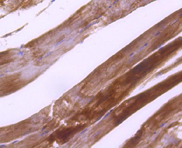 Immunohistochemical analysis of paraffin-embedded mouse skeletal muscle tissue using anti-Plectin antibody