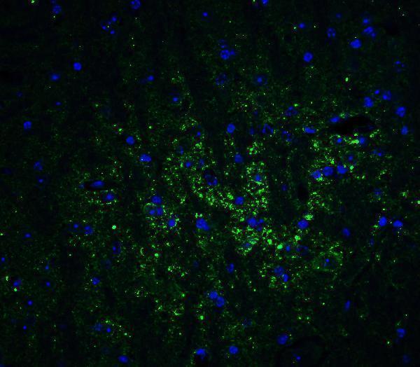 a01927 1 gabarapl2 primary antibodies if testing 5