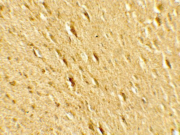 a01927 1 gabarapl2 primary antibodies ihc testing 2
