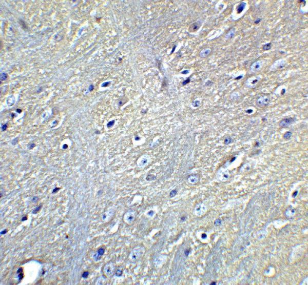 a01927 1 gabarapl2 primary antibodies ihc testing 4