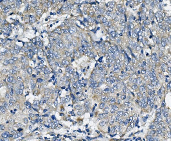 a01932 2 fis1 primary antibodies ihc testing 2
