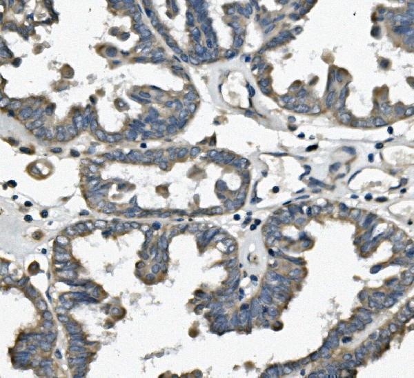 a01932 2 fis1 primary antibodies ihc testing 3