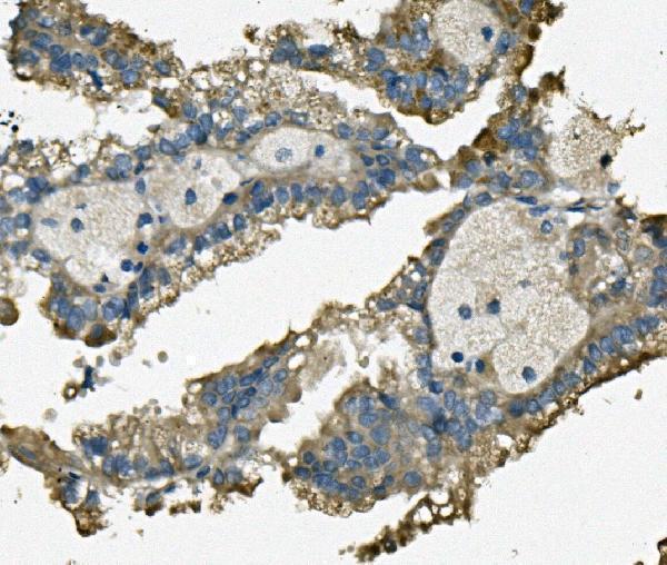 a01932 2 fis1 primary antibodies ihc testing 4