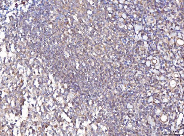  IHC analysis of TTC11/FIS1 using anti-TTC11/FIS1 antibody (A01932-3)