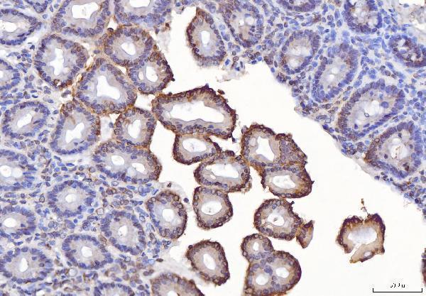 a01932 3 fis1 primary antibodies ihc testing 6