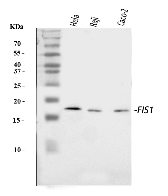  Western blot analysis of TTC11/FIS1 using anti-TTC11/FIS1 antibody (A01932-3)