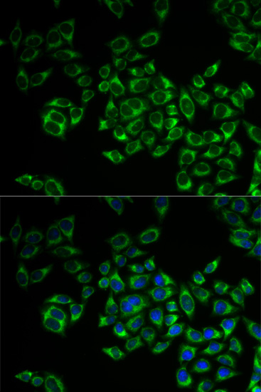 Immunoprecipitation analysis of 200ug extracts of MCF7 cells using 3ug TTC11/FIS1 antibody 