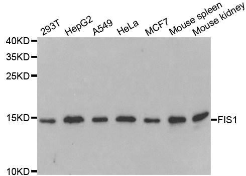 Western blot analysis of extracts of 293T cells, using TTC11/FIS1 Rabbit pAb  at 1:1000 dilution