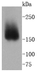 Western blot analysis of ITGA2 on A431 cells lysates using anti-ITGA2 antibody at 1/1,000 dilution