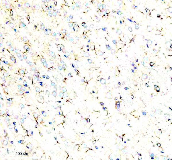  IHC analysis of KIF5B using anti-KIF5B antibody (A01934-2)