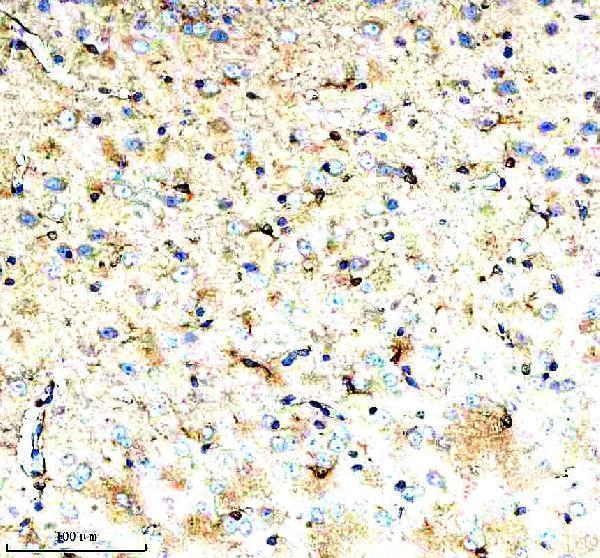  IHC analysis of KIF5B using anti-KIF5B antibody (A01934-2)