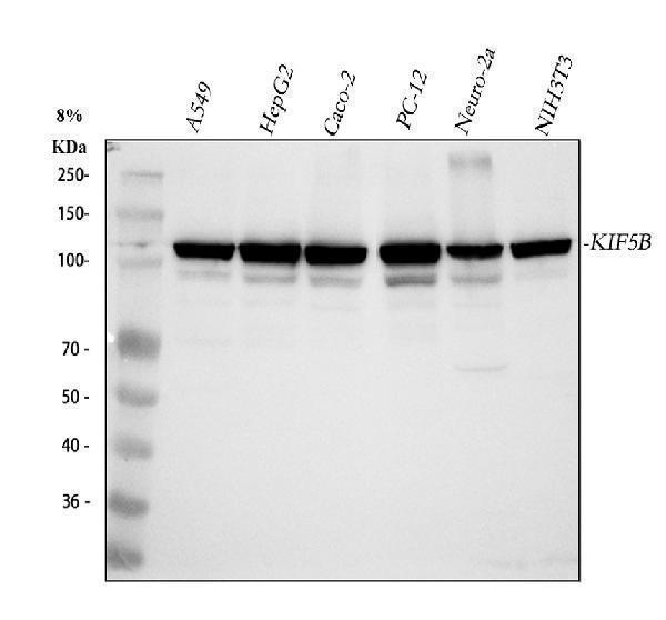  Western blot analysis of KIF5B using anti-KIF5B antibody (A01934-2)