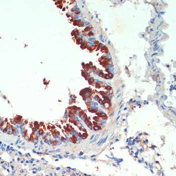 Immunohistochemistry of paraffin-embedded mouse lung using KIF5B antibody  at dilution of 1:200 