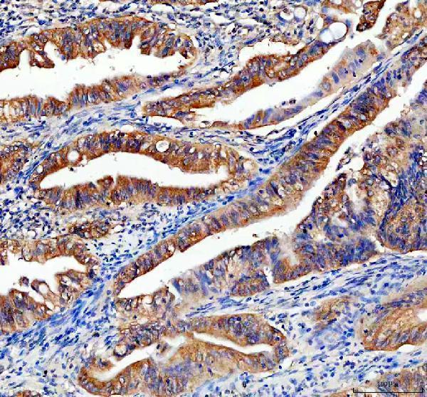 IHC analysis of CHMP2B using anti-CHMP2B antibody (A01935-1)