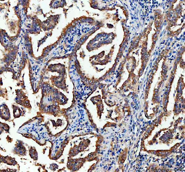 IHC analysis of CHMP2B using anti-CHMP2B antibody (A01935-1)
