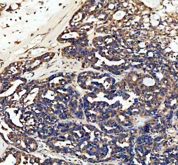 a01935 1 chmp2b primary antibodies ihc testing 3