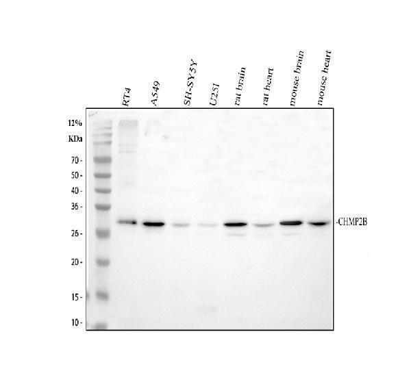Western blot analysis of CHMP2B using anti-CHMP2B antibody (A01935-1)