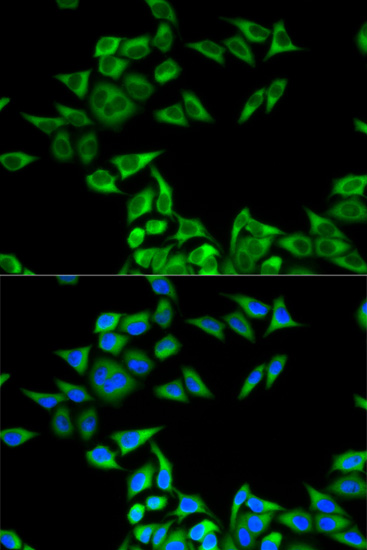 a01935 chmp2b primary antiboties if testing 3