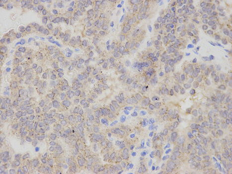 a01935 chmp2b primary antiboties ihc testing 2