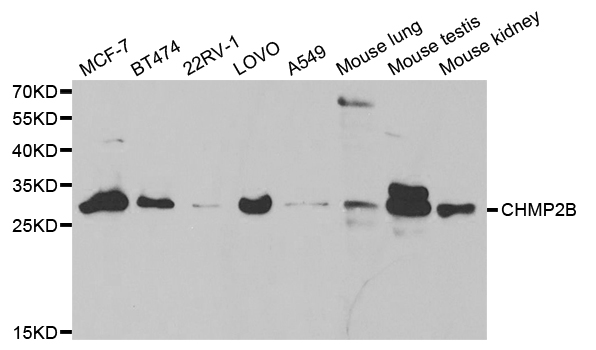 a01935 chmp2b primary antiboties wb testing 1