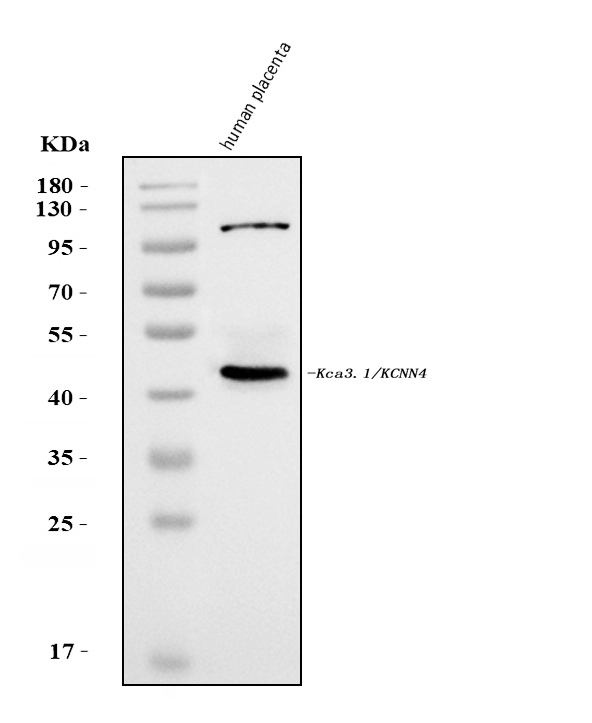 Western blot analysis of KCNN4 using anti-KCNN4 antibody (A01936-3)