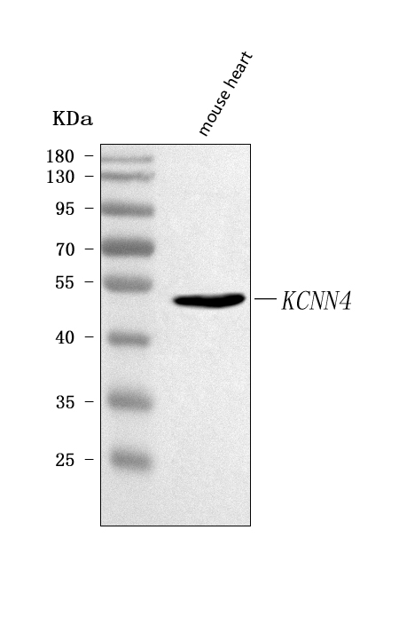  Western blot analysis of Kcnn4 using anti-Kcnn4 antibody (A01936-4)