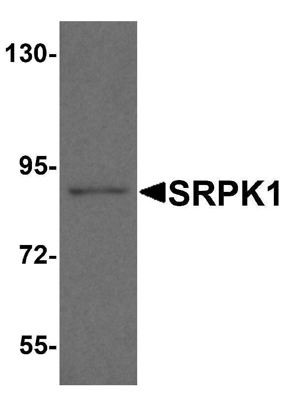 Western blot analysis of SRPK1 in mouse heart tissue lysate with SRPK1 antibody at 1 μg/ml
