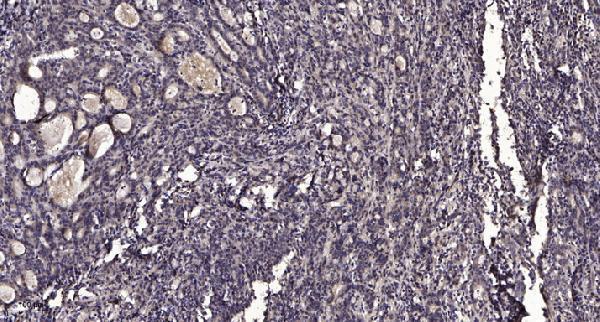 a01938 six1 primary antibodies ihc testing 1