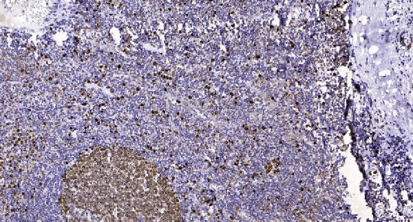a01939 nipbl primary antibodies ihc testing 1
