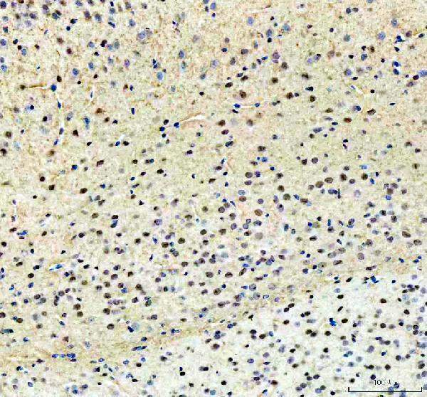 a01940 prkcb primary antibodies ihc testing 2