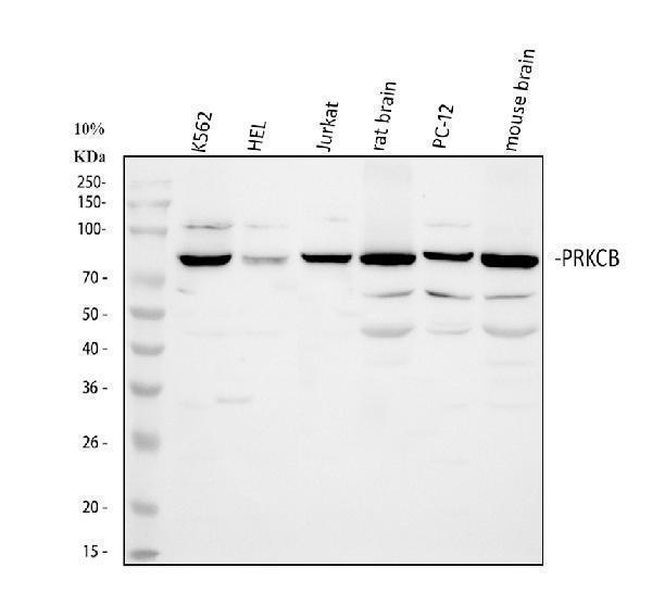 a01940 prkcb primary antibodies wb testing 1