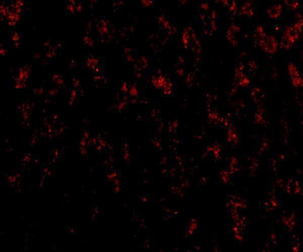 Immunofluorescence of OMI in Human Liver cells with OMI antibody at 20 μg/mL