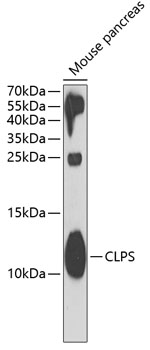Western blot analysis of extracts of mouse pancreas, using CLPS antibody  at 1:1000 dilution