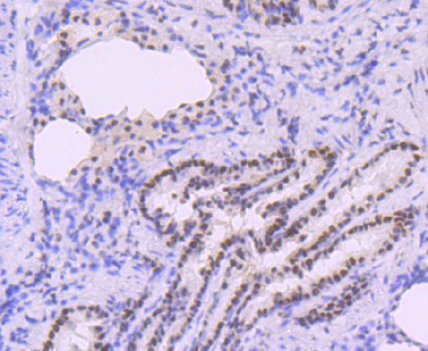 Immunohistochemical analysis of paraffin-embedded rat lung tissue using anti-DNA Polymerase beta antibody