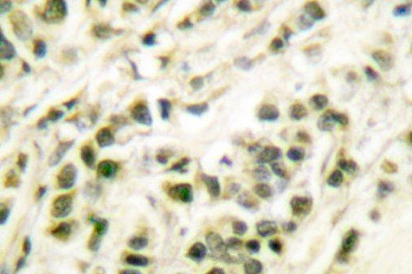 a01946 polb primary antiboties ihc testing 2