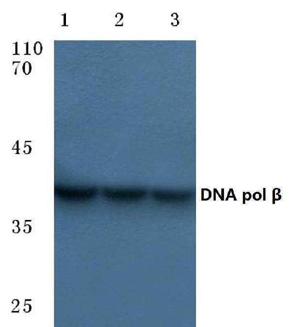 a01946 polb primary antiboties wb testing 1