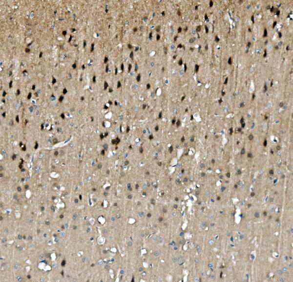  IHC analysis of TORC1/CRTC1 using anti-TORC1/CRTC1 antibody (A01951-3)