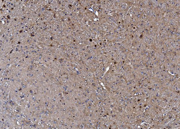 a01951 3 crtc1 primary antibodies ihc testing 4