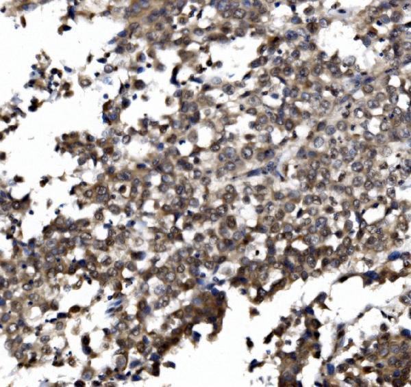 a01951 3 crtc1 primary antibodies ihc testing 5