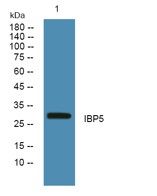 Western blot analysis of lysates from A431 cells, primary antibody was diluted at 1:1000, 4°over night
