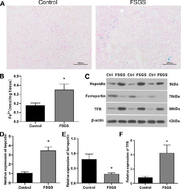 FSGS rats showed iron metabolism disorder