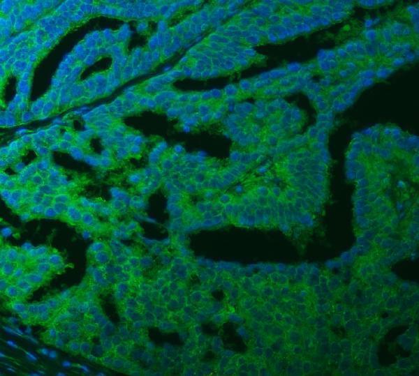 a01953 2 slc40a1 primary antibodies if testing 7
