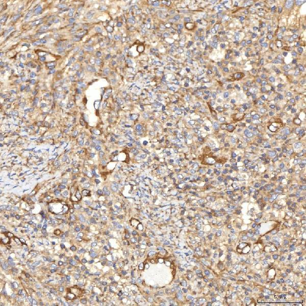  IHC analysis of SLC40A1 using anti-SLC40A1 antibody (A01953-2)