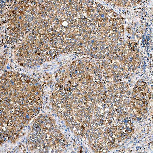 a01953 2 slc40a1 primary antibodies ihc testing 3