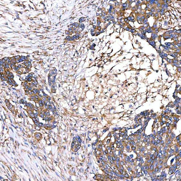 a01953 2 slc40a1 primary antibodies ihc testing 4