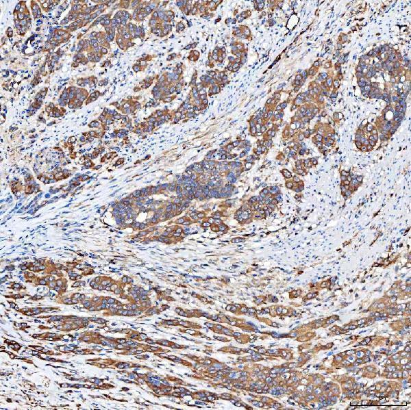 a01953 2 slc40a1 primary antibodies ihc testing 5