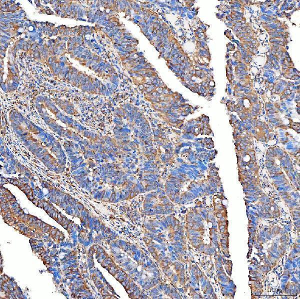 a01953 2 slc40a1 primary antibodies ihc testing 6