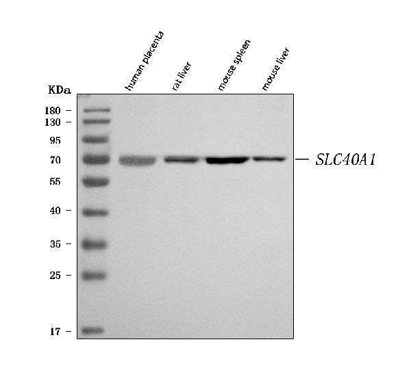  Western blot analysis of SLC40A1 using anti-SLC40A1 antibody (A01953-2)