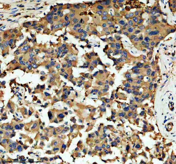 IHC analysis of Ferritin light chain/FTL using anti-Ferritin light chain/FTL antibody (A01956-1)