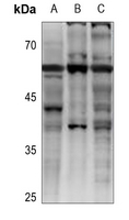 a01958 gpbar1 primary antiboties wb testing 1